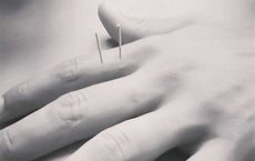 Exploring Acupuncture An Ancient Practice for Modern Wellness